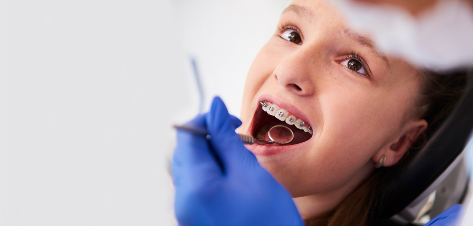 Ортодонтичне лікування