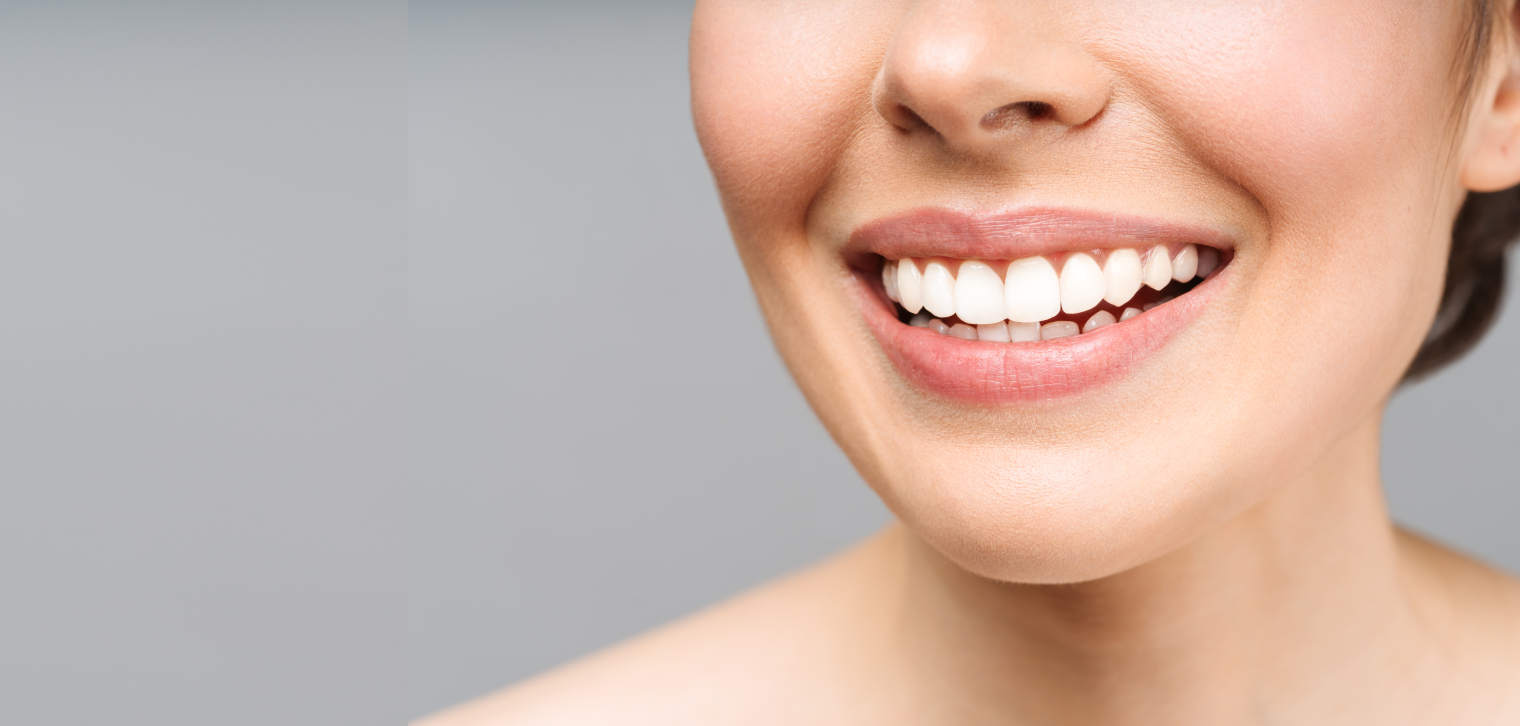 Відбілювання зубів