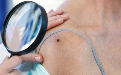 Дерматовенерологія